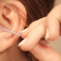 מסיר בבטחה הצטברות שעוות אוזניים