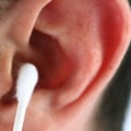 כמה זמן אתה משאיר הסרת שעוות אוזניים?