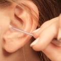 האם זה נורמלי שהאוזן שלך תפגע לאחר הסרת שעווה?